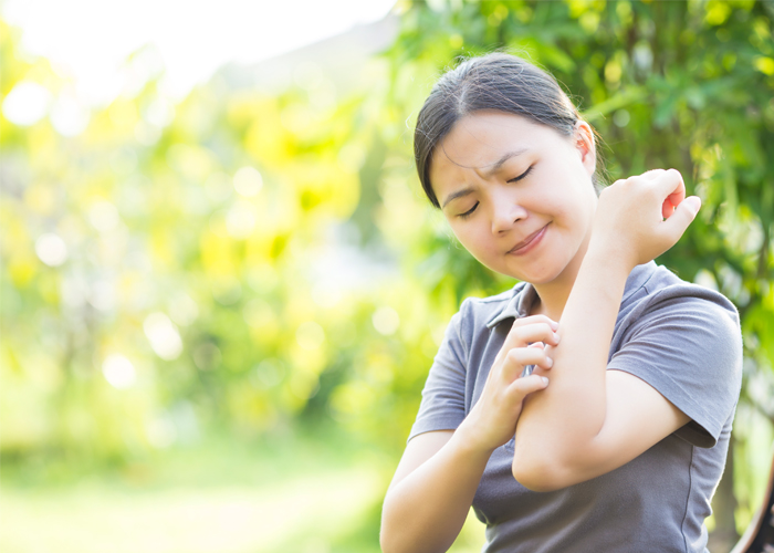 Why does hayfever make eczema worse?